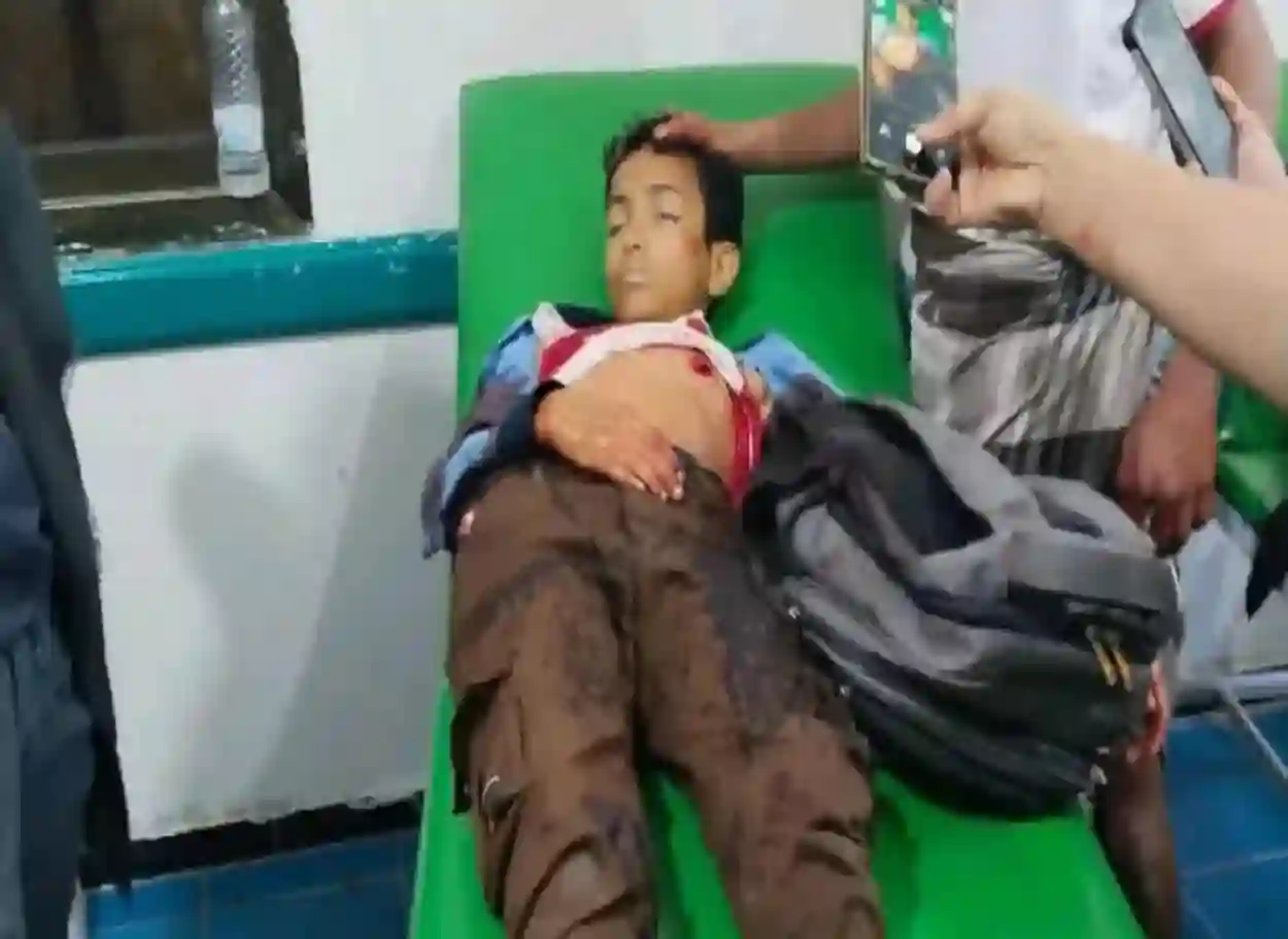 تعز.. مقتل طفل برصاص قناص حوثي أثناء عودته من المدرسة